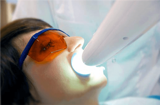 Understanding the Causes of Teeth Sensitivity Watford