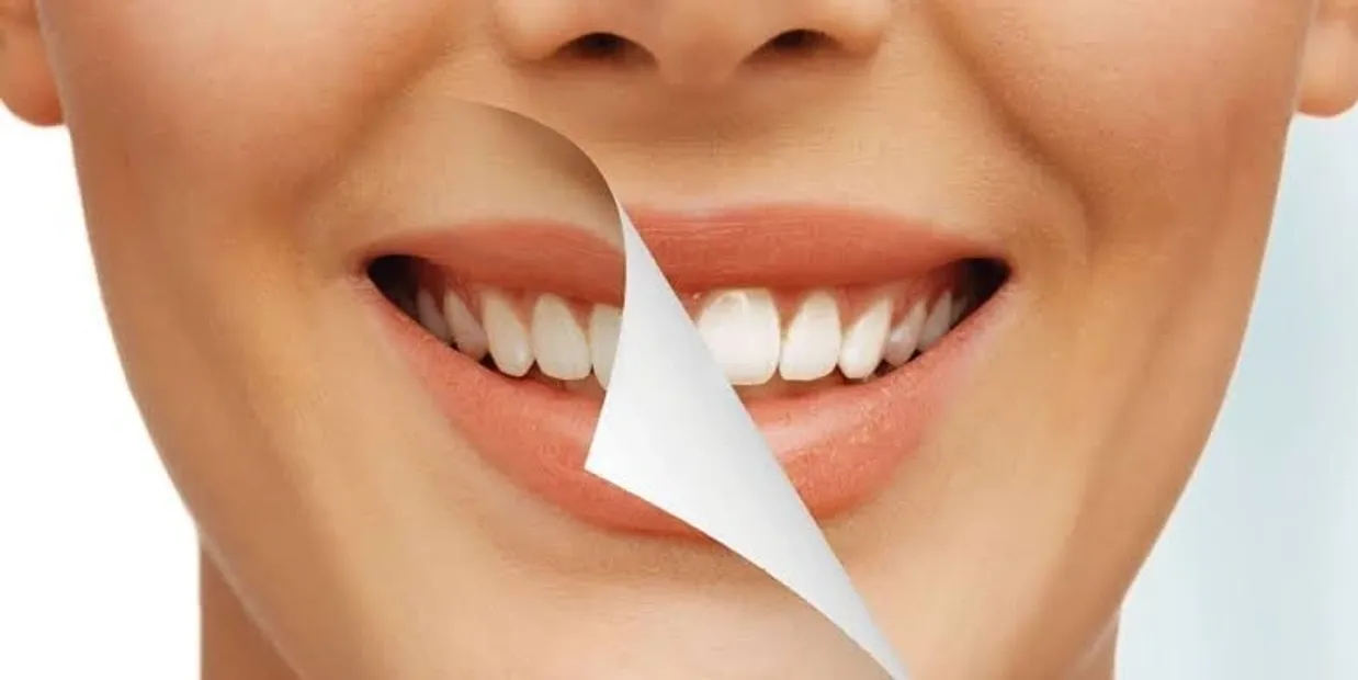 What Is Cosmetic Dentistry and How Can It Transform Your Smile Watford