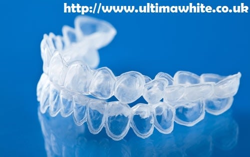 Bleaching Trays vs At-Home Laser Teeth Whitening Watford