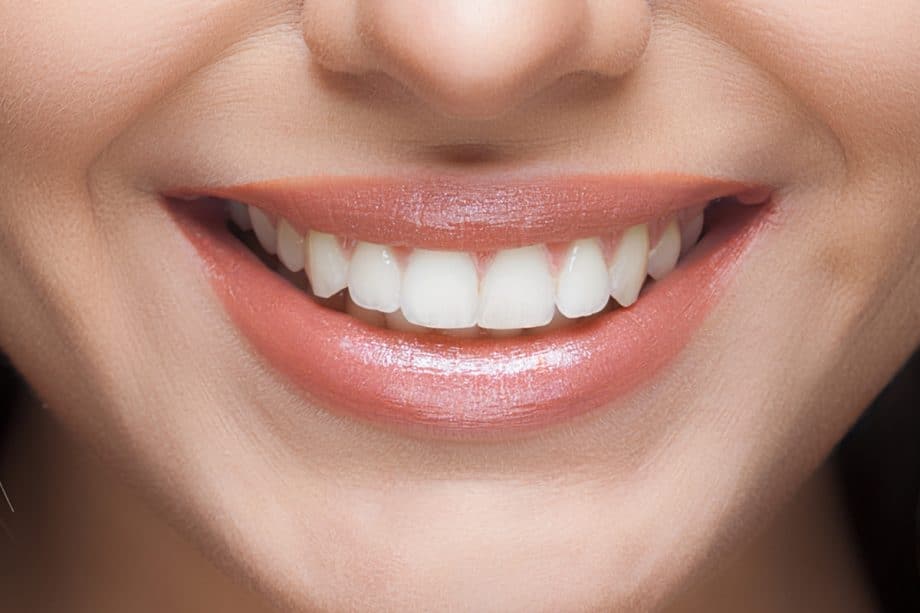 The Impact of White Spots on Oral Health Watford