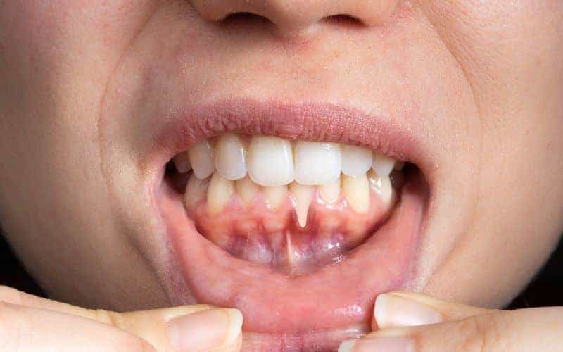 Final Thoughts: Building Lifelong Enamel Protection Habits Watford