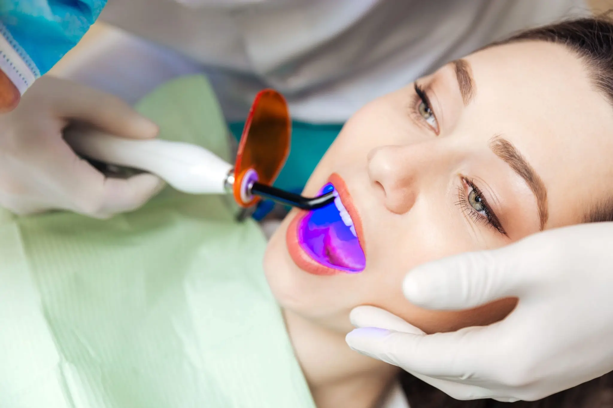 How Long Can You Expect Laser Teeth Whitening Results to Last Watford?