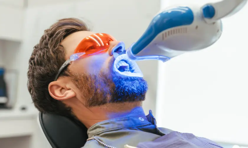 Who Should Avoid Laser Teeth Whitening Due to Higher Risk Factors Watford?