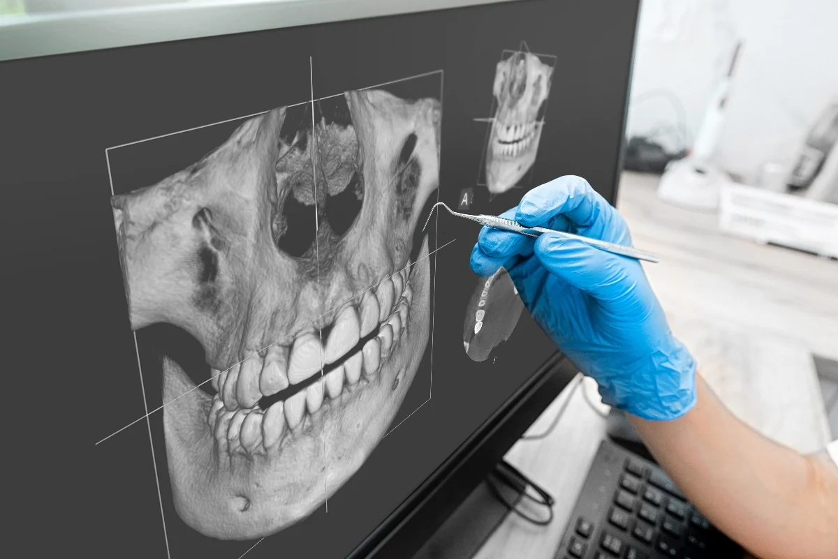 Key Benefits of 3D Printing for Patients and Dentists Watford