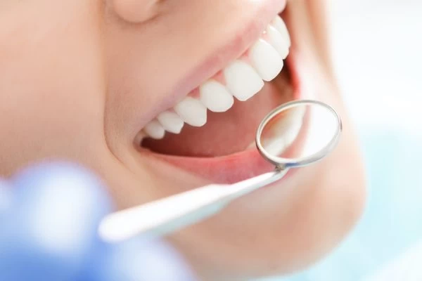 Preventing White Spots on Teeth Watford
