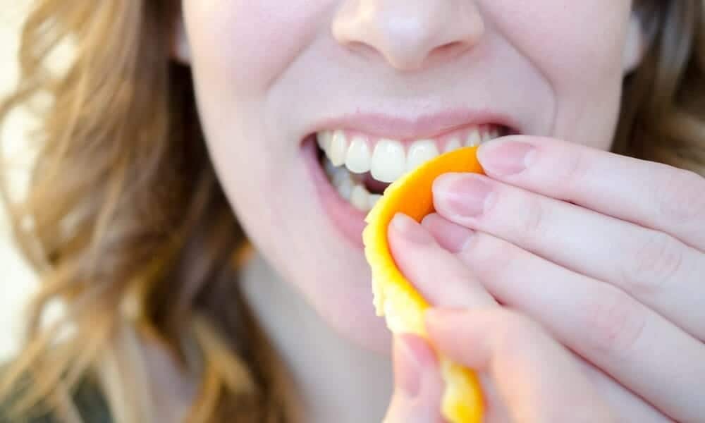 How Long Does Natural Teeth Whitening Take to Show Results Watford?