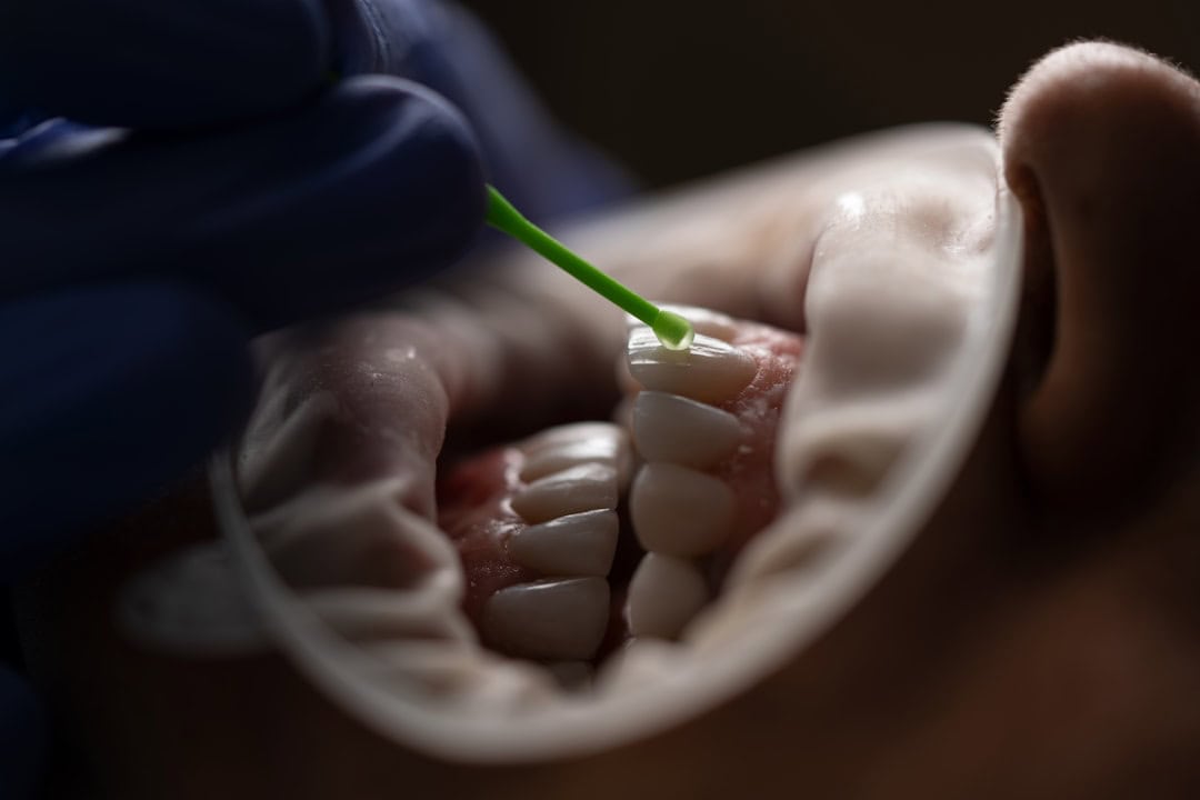 Common Causes of Persistent Dry Mouth Watford