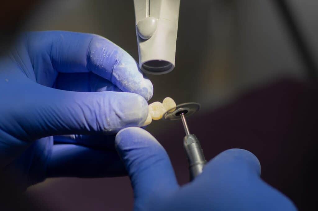 Customised Dental Solutions: Crowns, Aligners, and Implants Watford