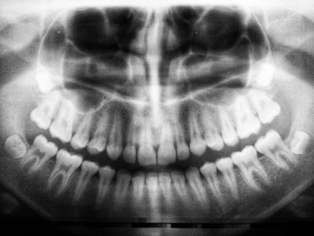 The Future of 3D Printing in Oral Healthcare Watford