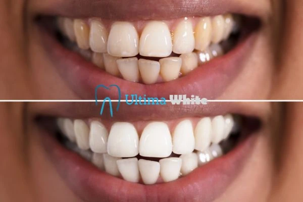 Long lasting results from Ultima White Watford